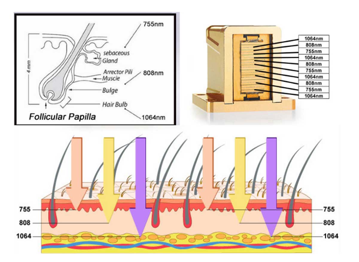 Diode Laser Triple Wave